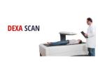 Future-Proofing Health: The Comprehensive Scope of Dexa Scans