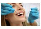 Trusted Dental Implant Experts in Melbourne