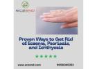 Proven Ways to Get Rid of Eczema, Psoriasis, and Ichthyosis