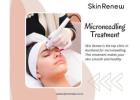 Micro Needling Treatment in Whangaparaoa, Auckland 