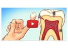 The Best Bad Breath Treatment for Fresh and Healthy Gums